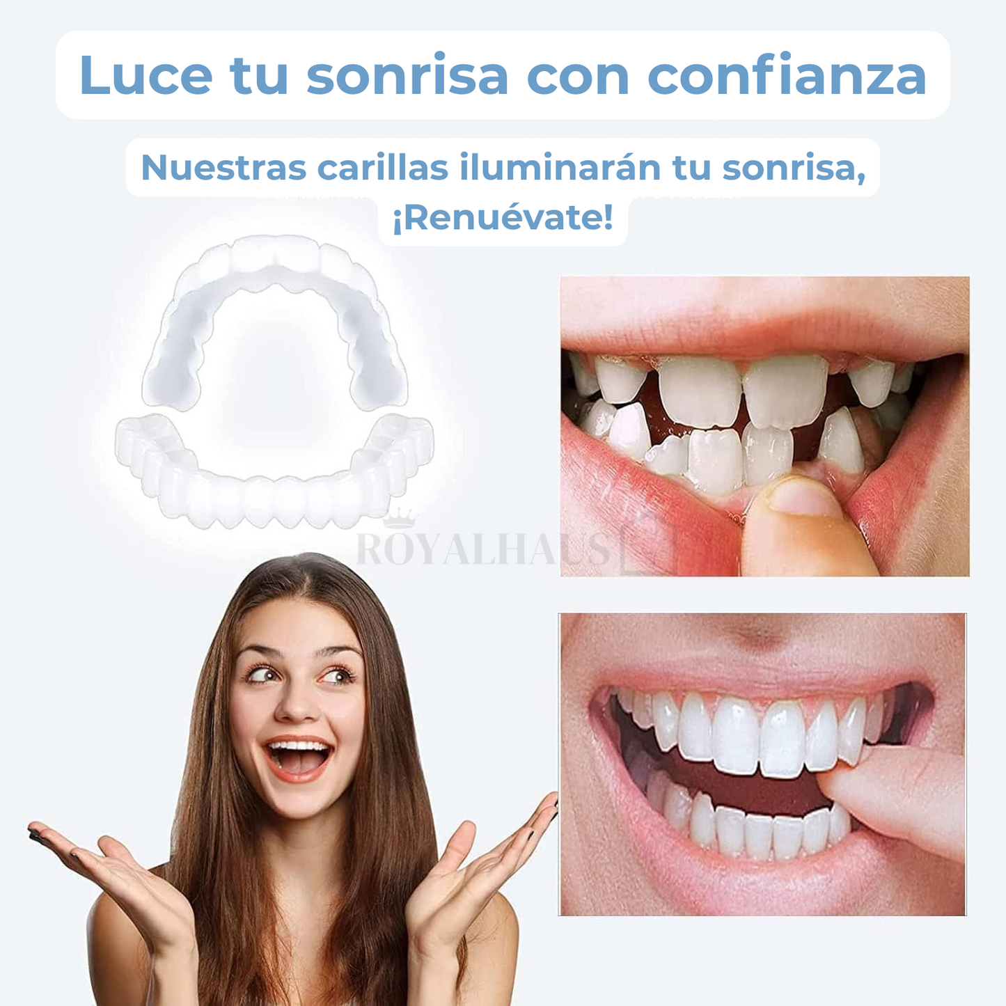 Carillas Dentales - Sonrisa perfecta al instante