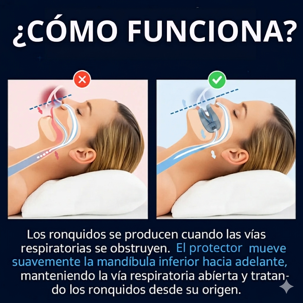 AntiSnore™ Protector Antirronquidos y Bruxismo - Duerme sin interrupciones desde la primera noche