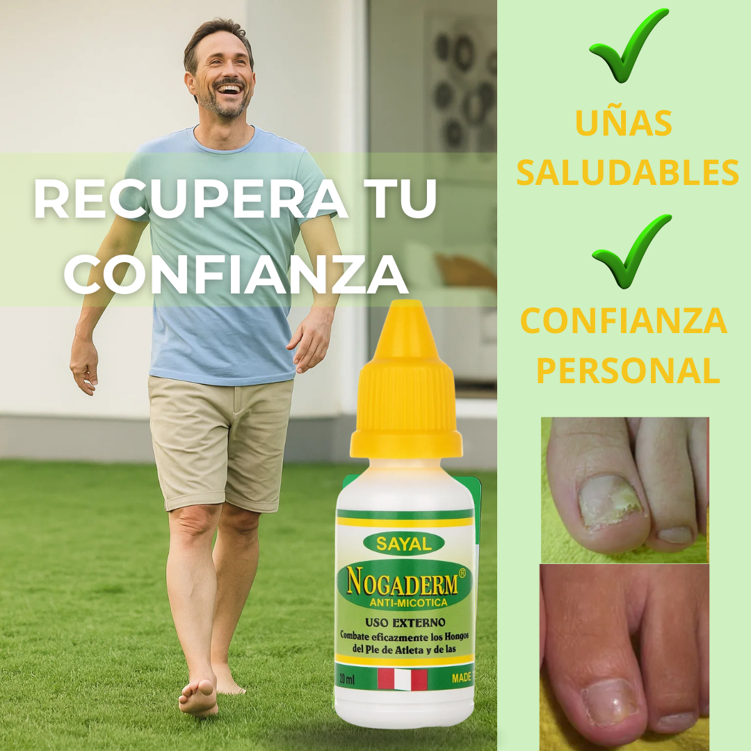 TRATAMIENTO EFECTIVO ANTIHONGOS – Uñas limpias y saludables en 4 semanas