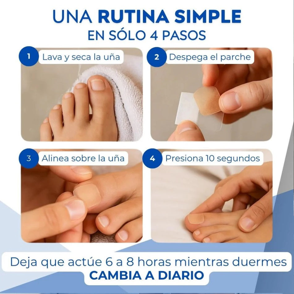 Parche Nocturno - Repara Daños - Mejora la Apariencia de tus Uñas en 8 Semanas