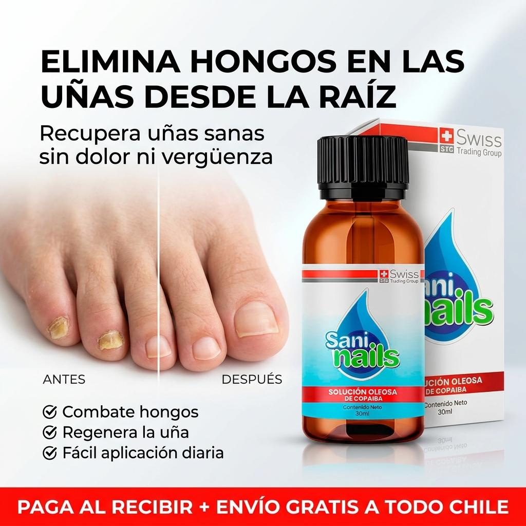 SaniNails™ - Tratamiento Antihongos - Mejora Visible de Uñas en 4 Semanas