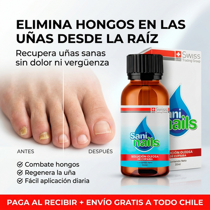 SaniNails™ - Tratamiento Antihongos - Mejora Visible de Uñas en 4 Semanas