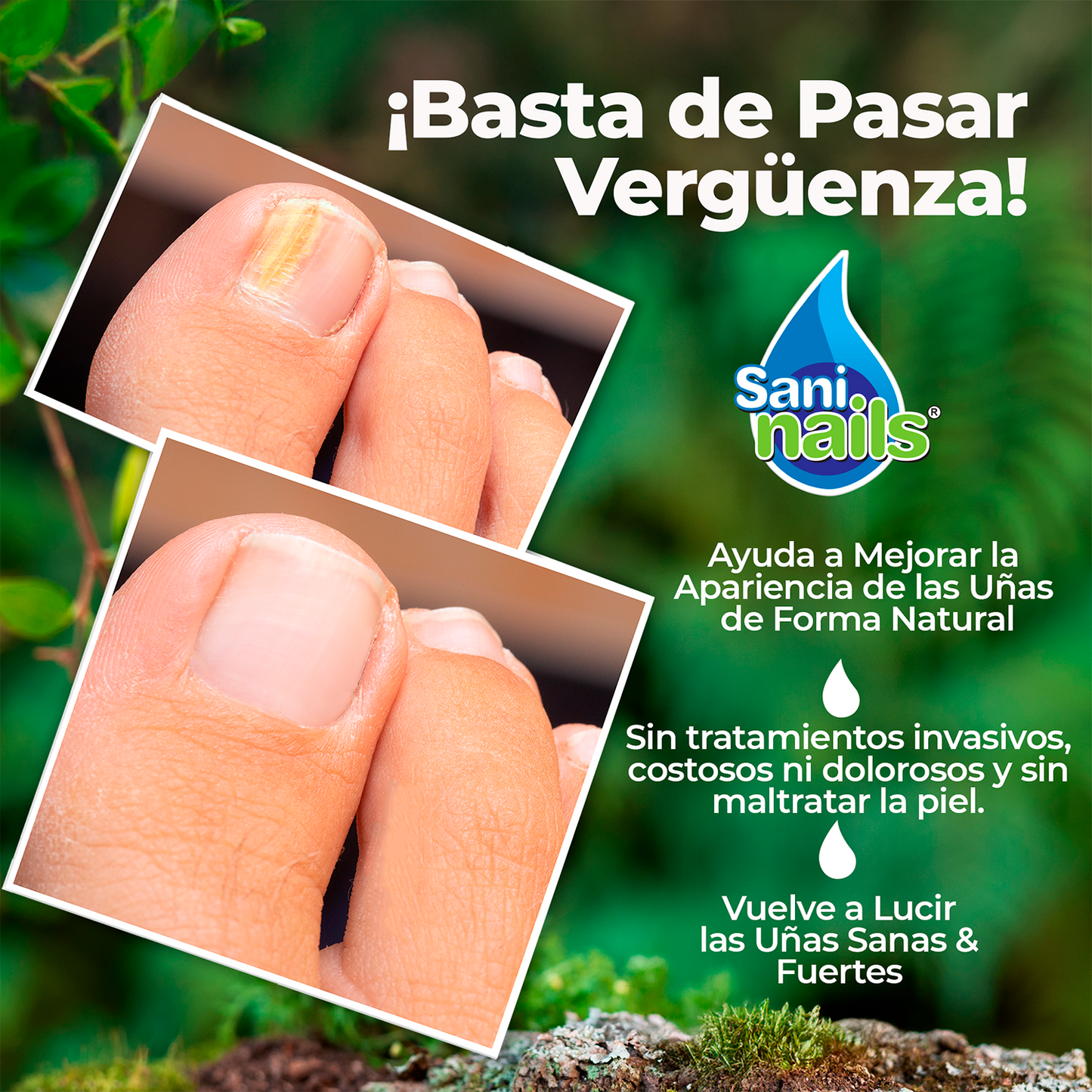 SaniNails™ - Tratamiento Antihongos - Mejora Visible de Uñas en 4 Semanas