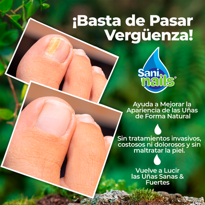 SaniNails™ - Tratamiento Antihongos - Mejora Visible de Uñas en 4 Semanas