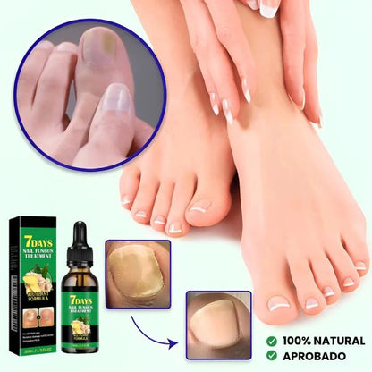 SERUM 7 DAYS – Uñas limpias y saludables en 4 semanas