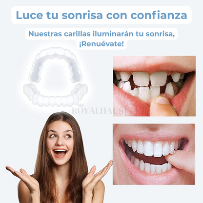 Carillas Dentales - Sonrisa perfecta al instante