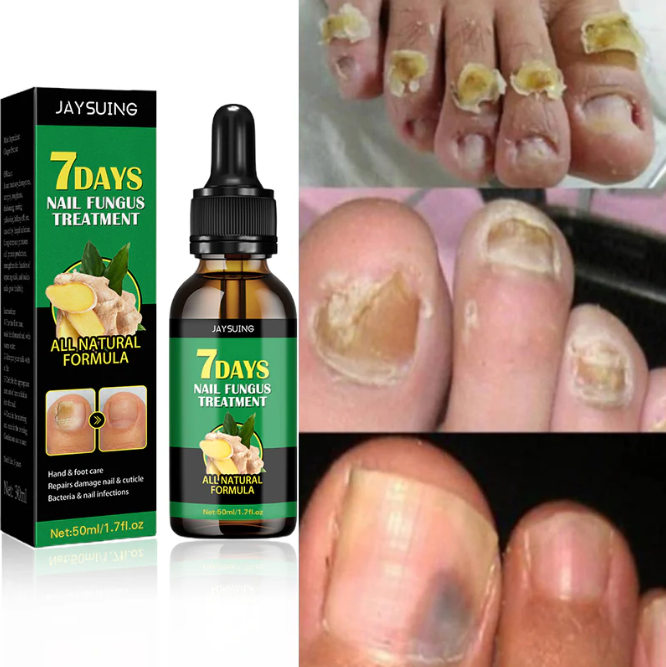 SERUM 7 DAYS – Uñas limpias y saludables en 4 semanas