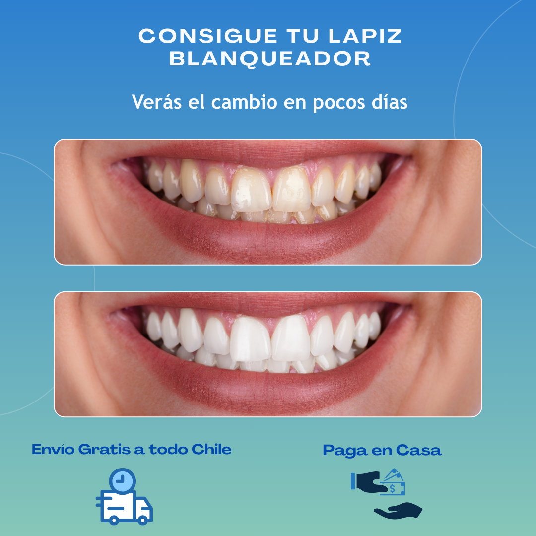 Lapiz Blanqueador de Dientes
