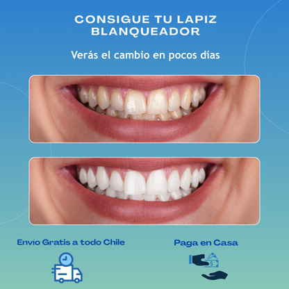 Lapiz Blanqueador de Dientes