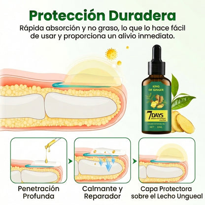 Aceite Antifúngico - Restauración de Uñas - Ayuda a recuperar la salud de tus pies