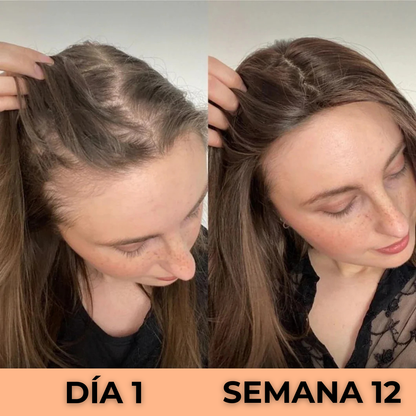 Aceite de Semilla de Calabaza - Cabello Más Fuerte y Piel Saludable en 120 Días