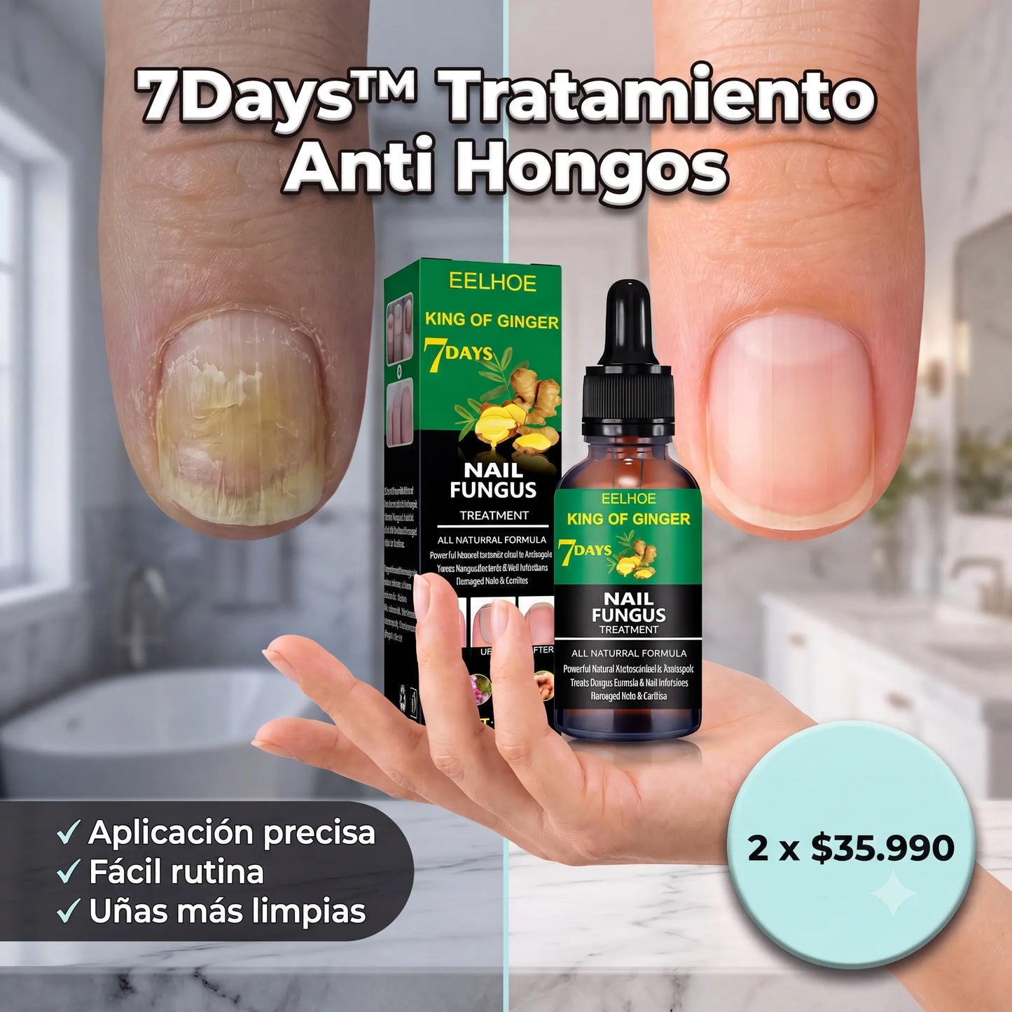 7Days™ Tratamiento Anti Hongos - Elimina Uñas Amarillas y las Fortalece desde 7 Días