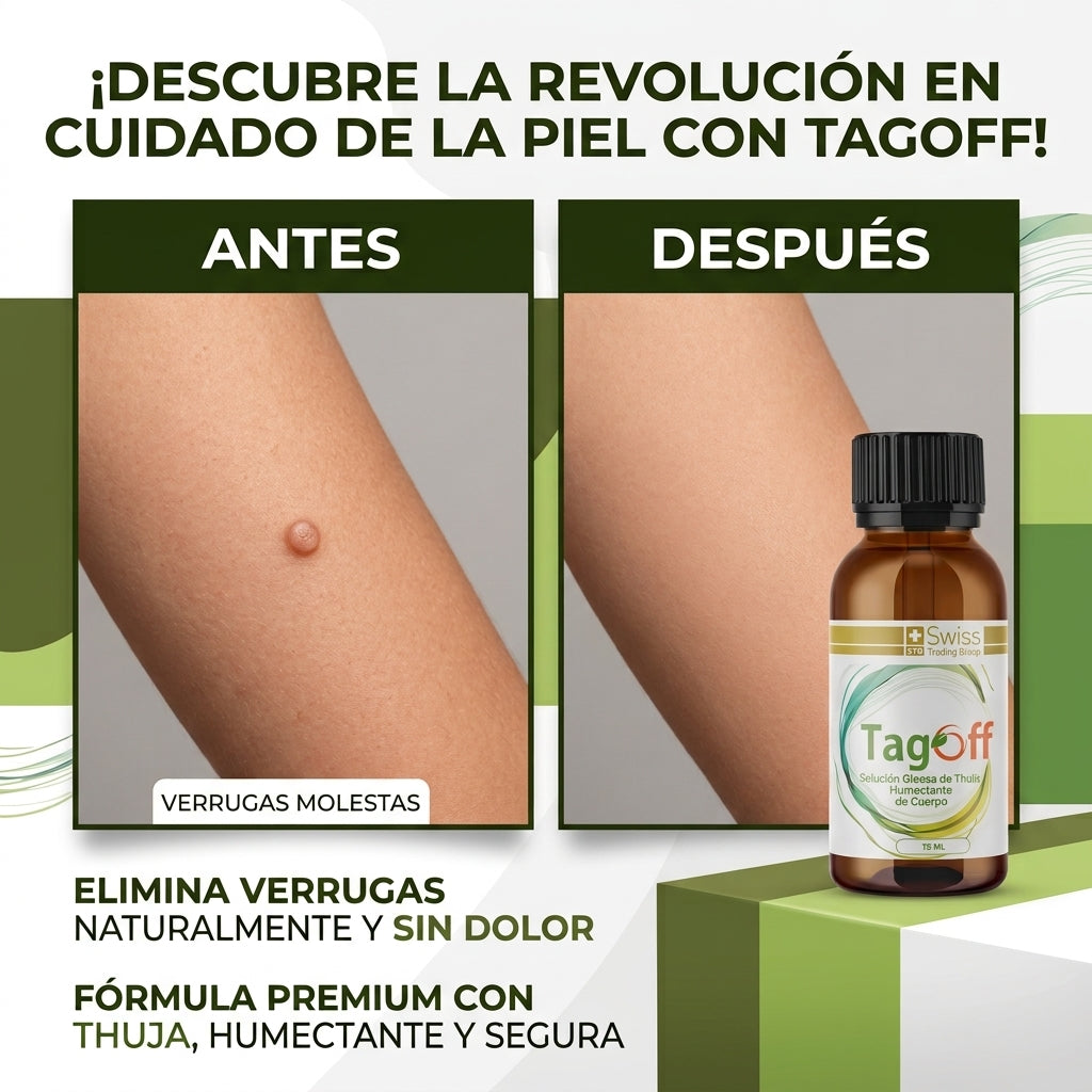 TagOff™ – Elimina Verrugas y Carnosidades en 30 Días