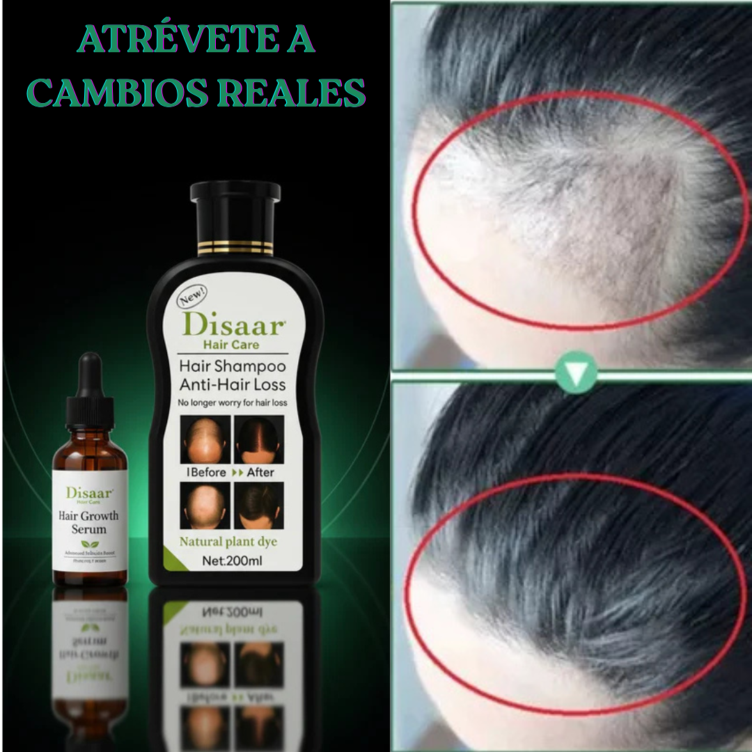 Tratamiento Anticaída – Detén la caída y luce un cabello más fuerte y con vida en semanas + SERUM de Regalo