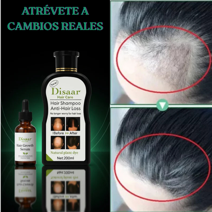 Tratamiento Anticaída – Detén la caída y luce un cabello más fuerte y con vida en semanas + SERUM de Regalo