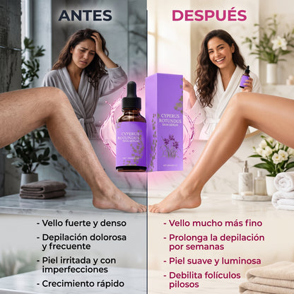 Aceite de Cyperus™ - Cuida tu zona íntima y piel - Elimina Manchas e Imperfecciones en 3 Días