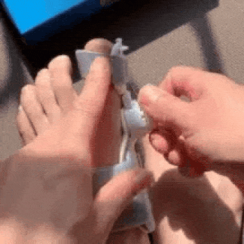 Corrector de Juanete Pro - Soporte Regulable -  Reduce la presión y mejora tu comodidad diaria