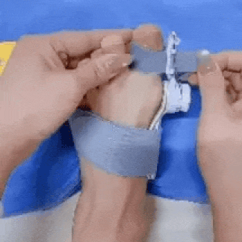 Corrector de Juanete Pro - Soporte Regulable -  Reduce la presión y mejora tu comodidad diaria