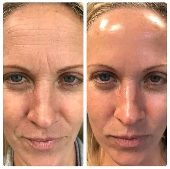 Mascarilla de Colágeno – Hidrata, reafirma y rejuvenece en minutos