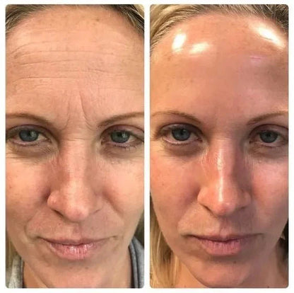 Mascarilla de Colágeno – Hidrata, reafirma y rejuvenece en minutos